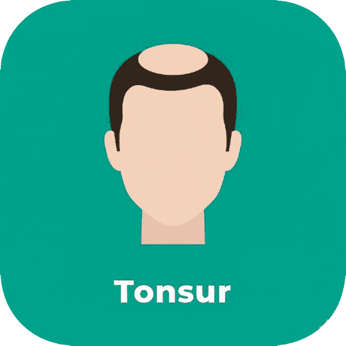 Tonsur