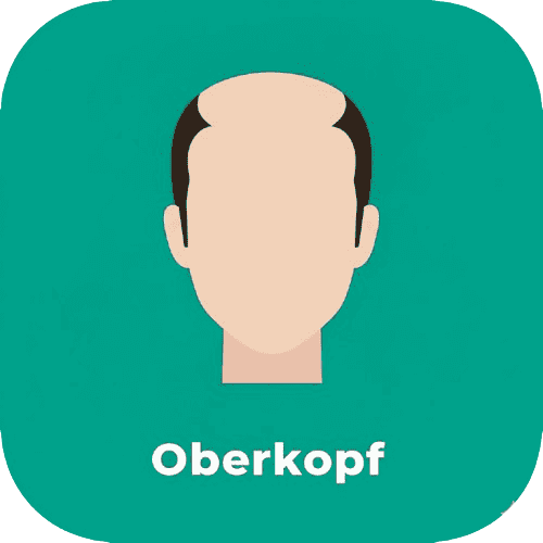 Oberkopf